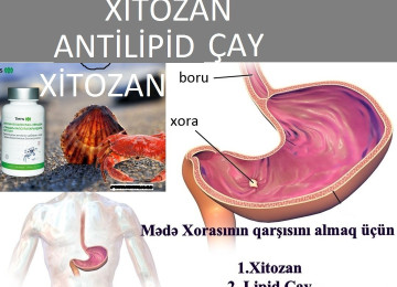 " Xitozan "-Depoda Bitdi Son 3 Qutu Əldə Satışda. Sual və